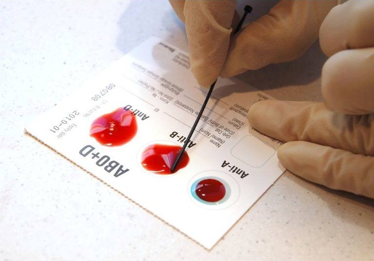 Rare and Rarest Blood Groups